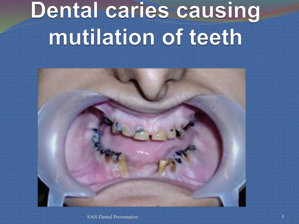 san dental presentation 2