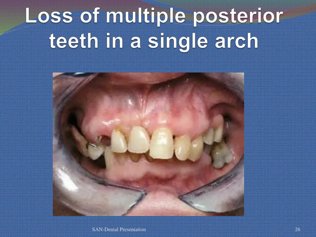 san dental presentation 21