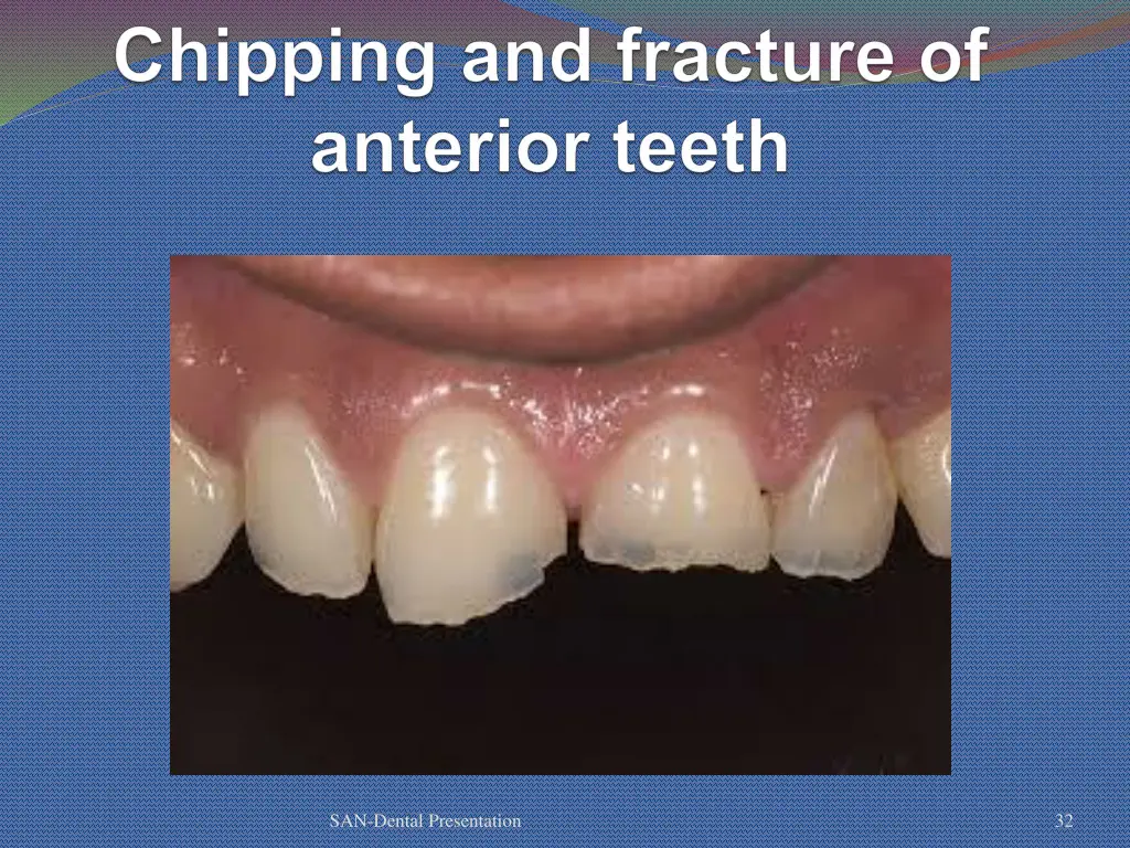 san dental presentation 27