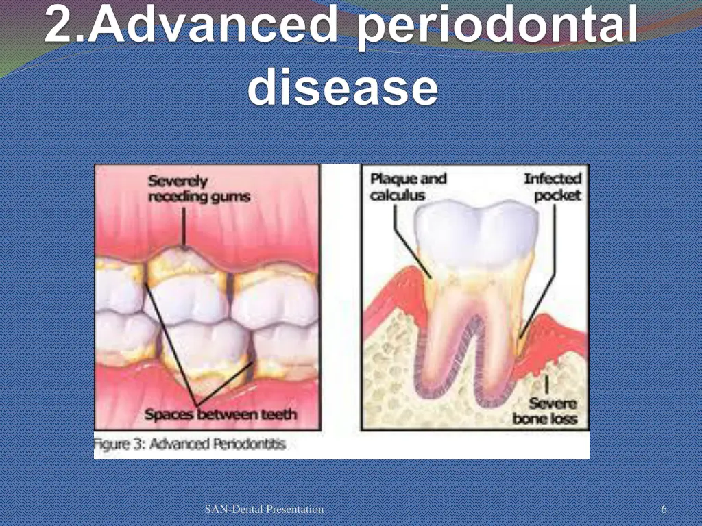 san dental presentation 3