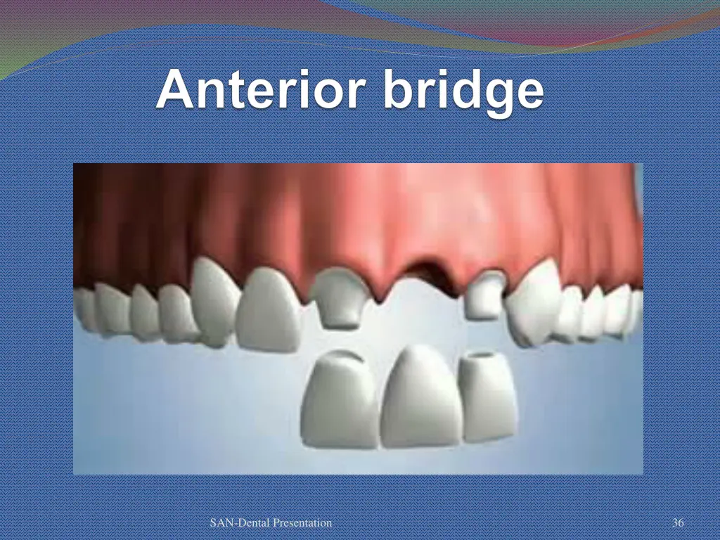 san dental presentation 30