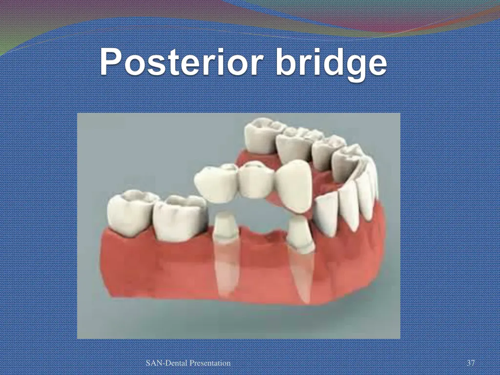 san dental presentation 31