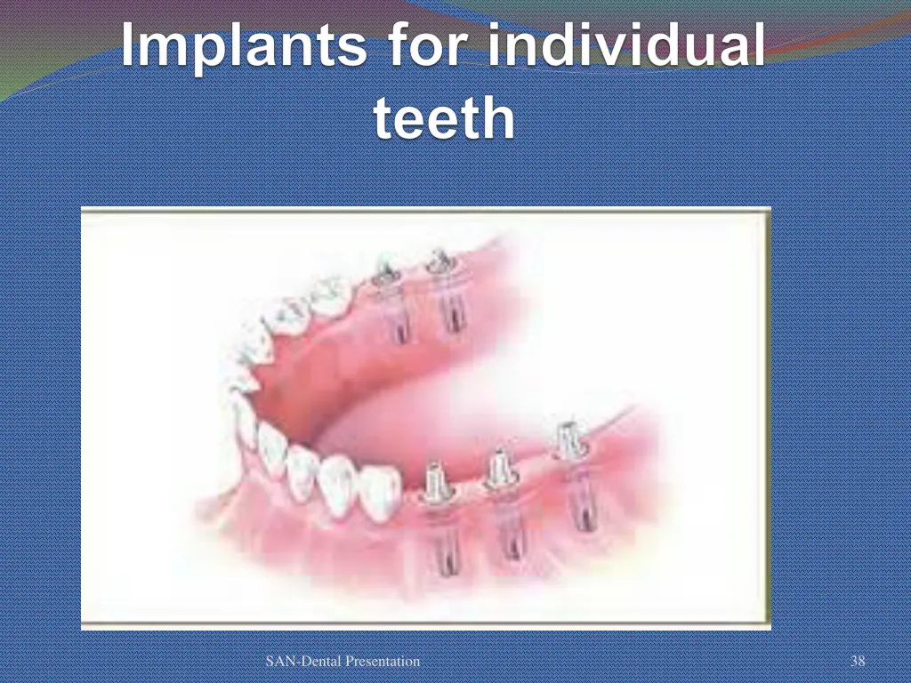 san dental presentation 32