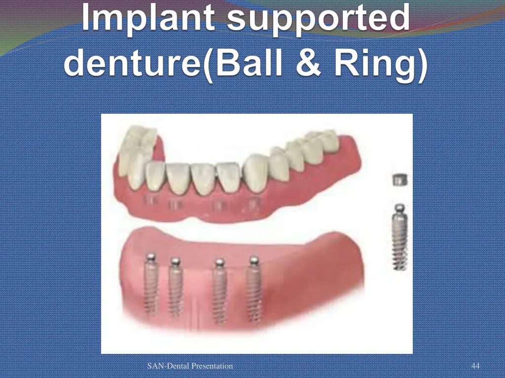 san dental presentation 38