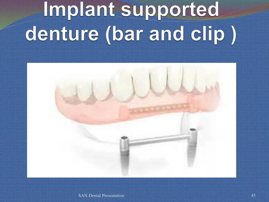 san dental presentation 39