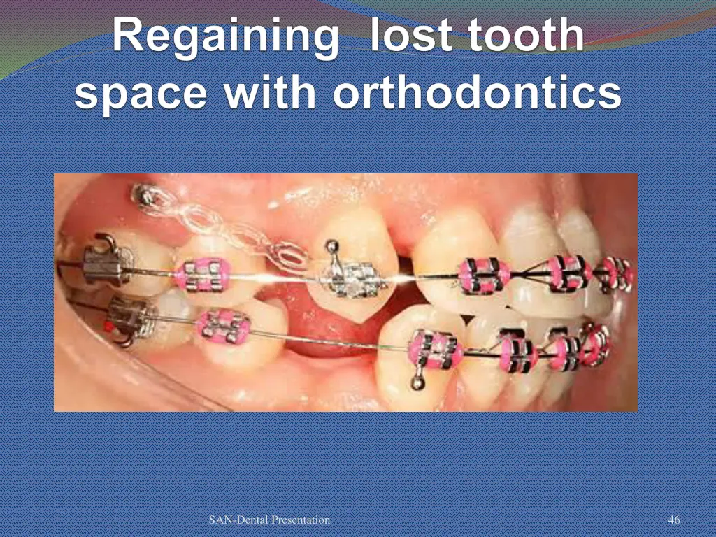 san dental presentation 40