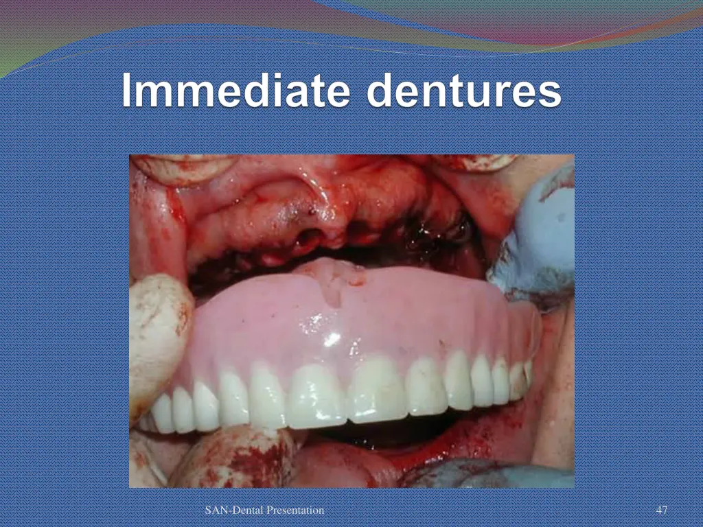 san dental presentation 41