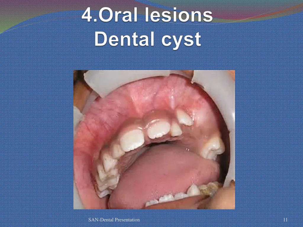 san dental presentation 8