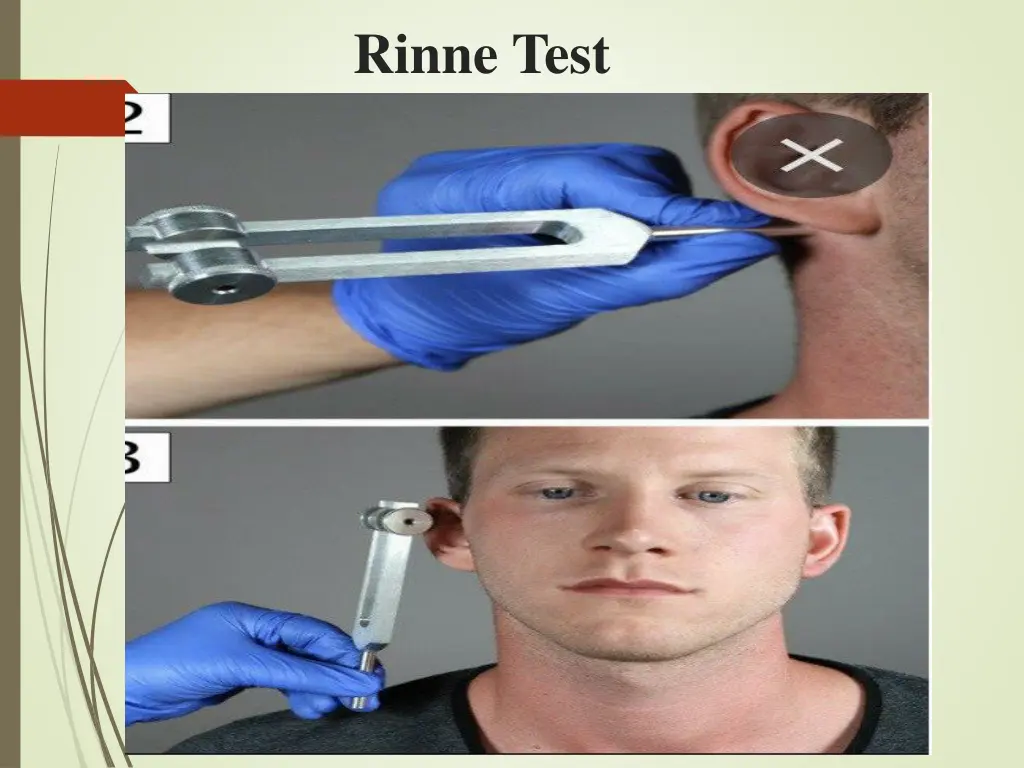 rinne test 1