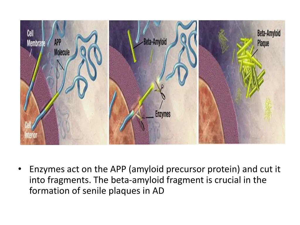 file amyloid plaque formation big jpg