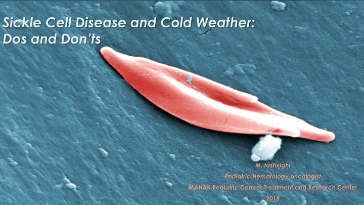 sickle cell disease and cold weather