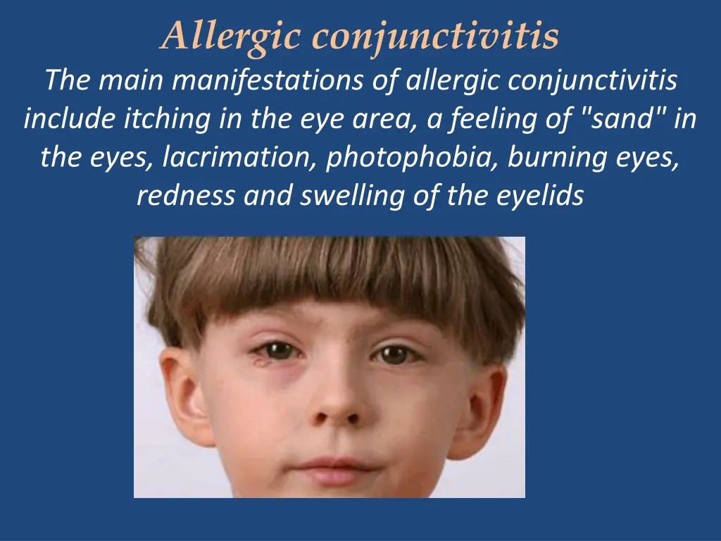 allergic conjunctivitis the main manifestations