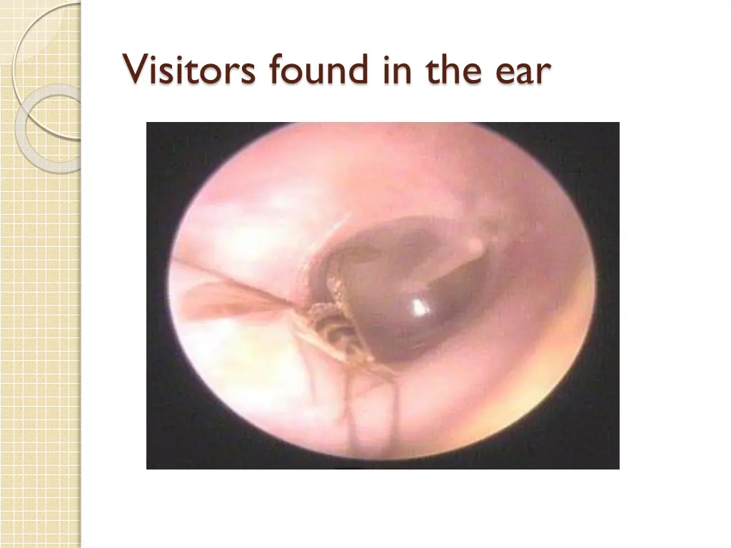 visitors found in the ear