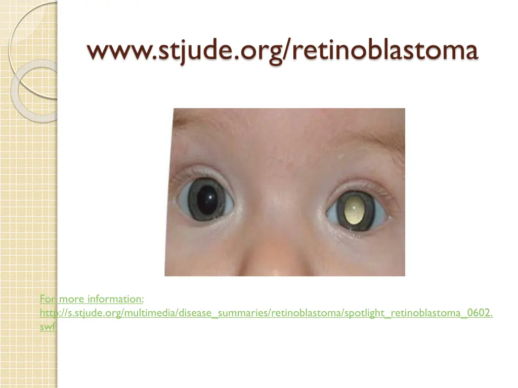 www stjude org retinoblastoma