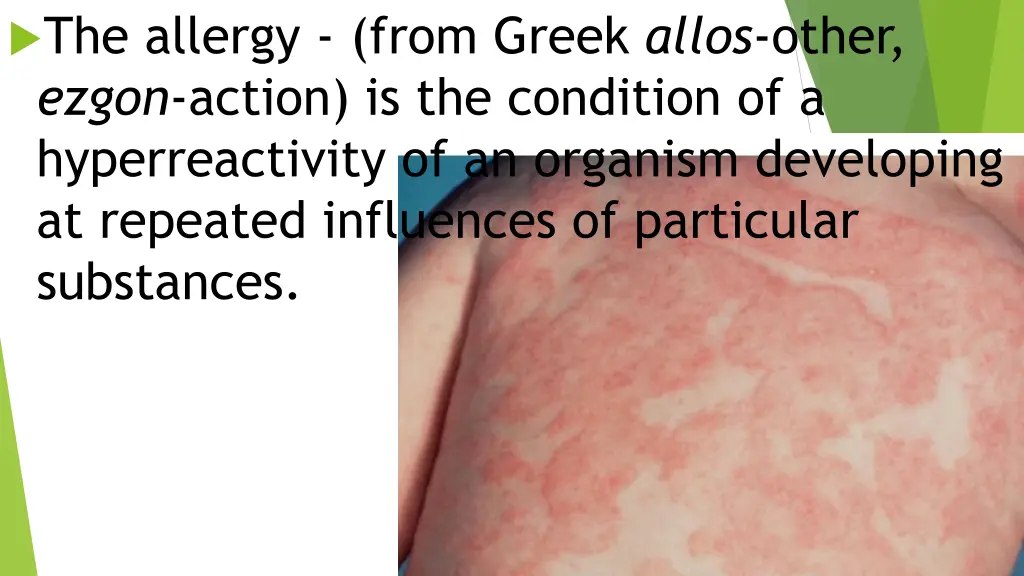 the allergy from greek allos other ezgon action