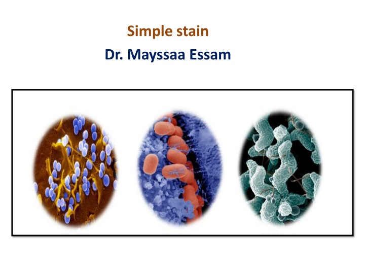 simple stain dr mayssaa essam