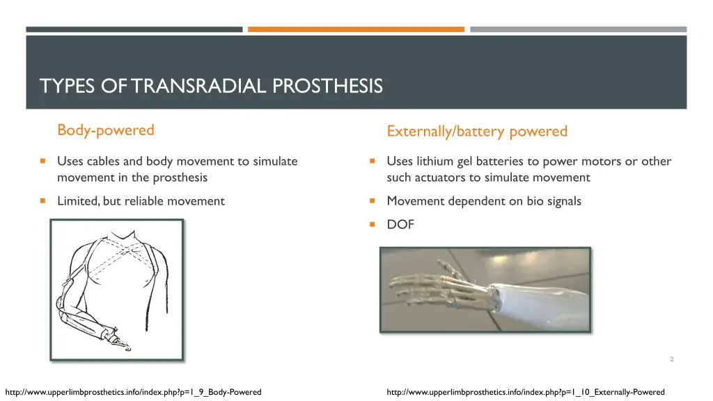 types of transradial prosthesis