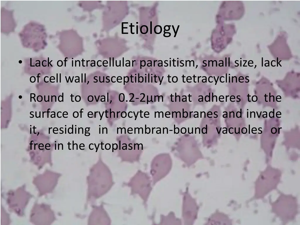 etiology