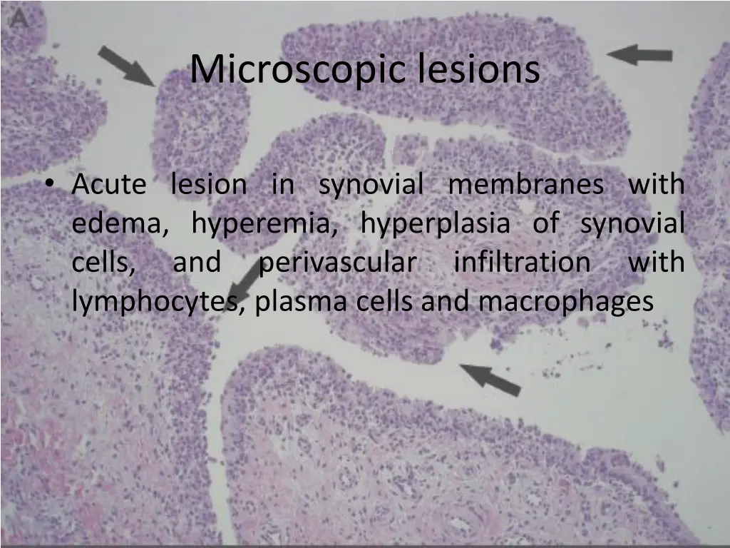 microscopic lesions 2