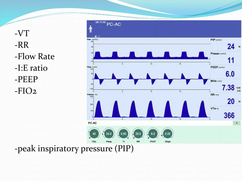 vt rr flow rate i e ratio peep fio2