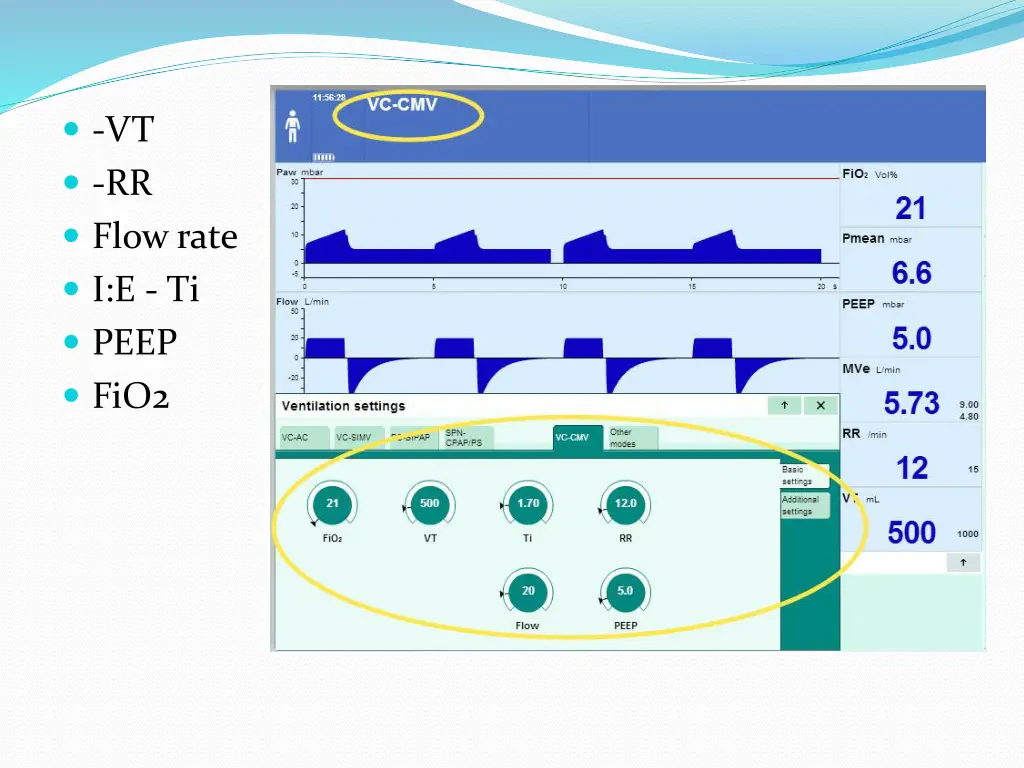 vt rr flow rate i e ti peep fio2