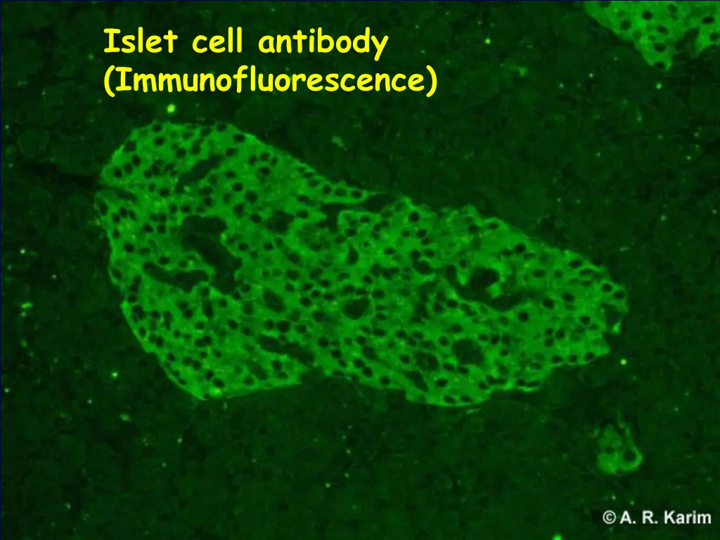 islet cell antibody immunofluorescence