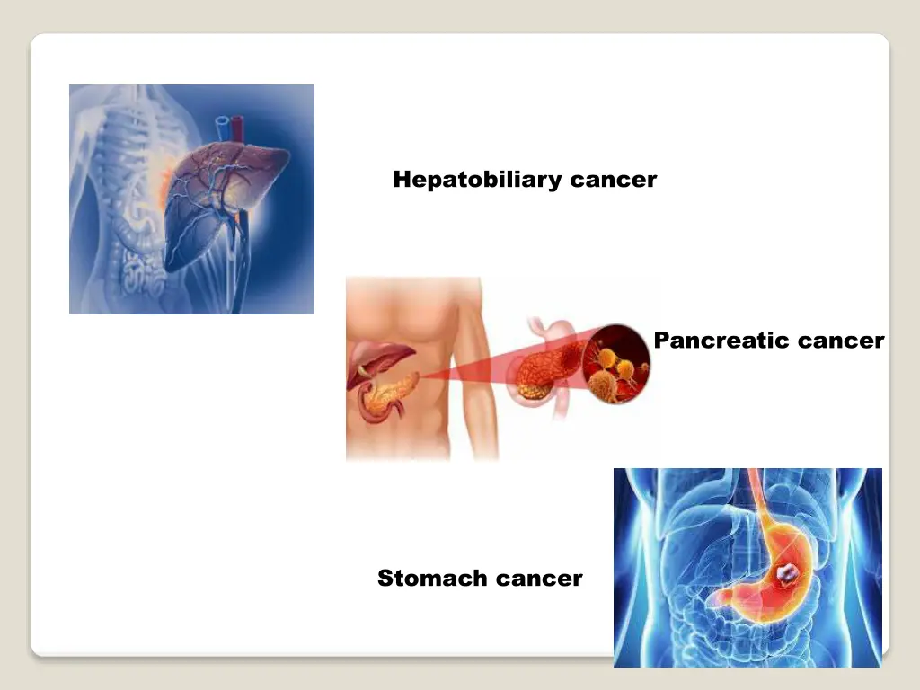 hepatobiliary cancer