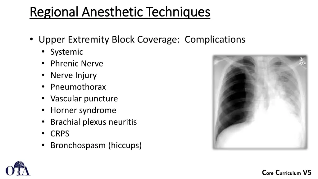 regional anesthetic techniques regional 1