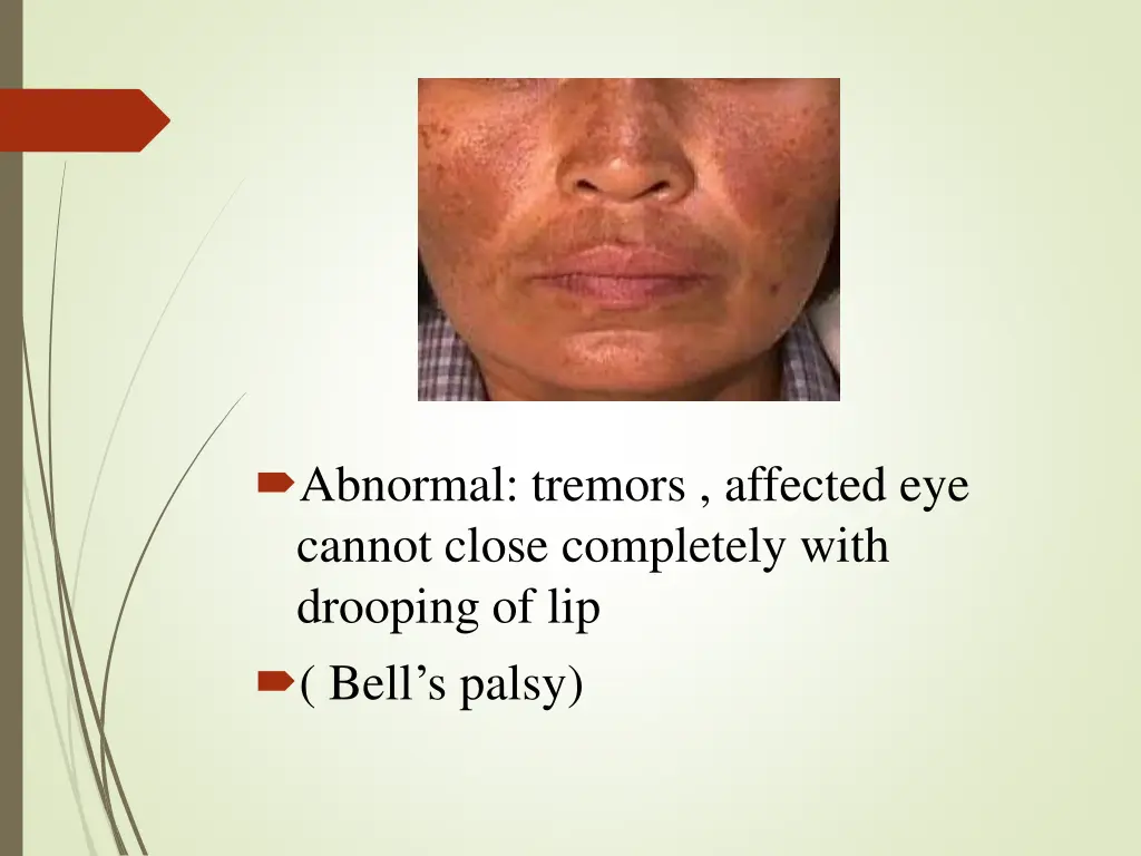 abnormal tremors affected eye cannot close