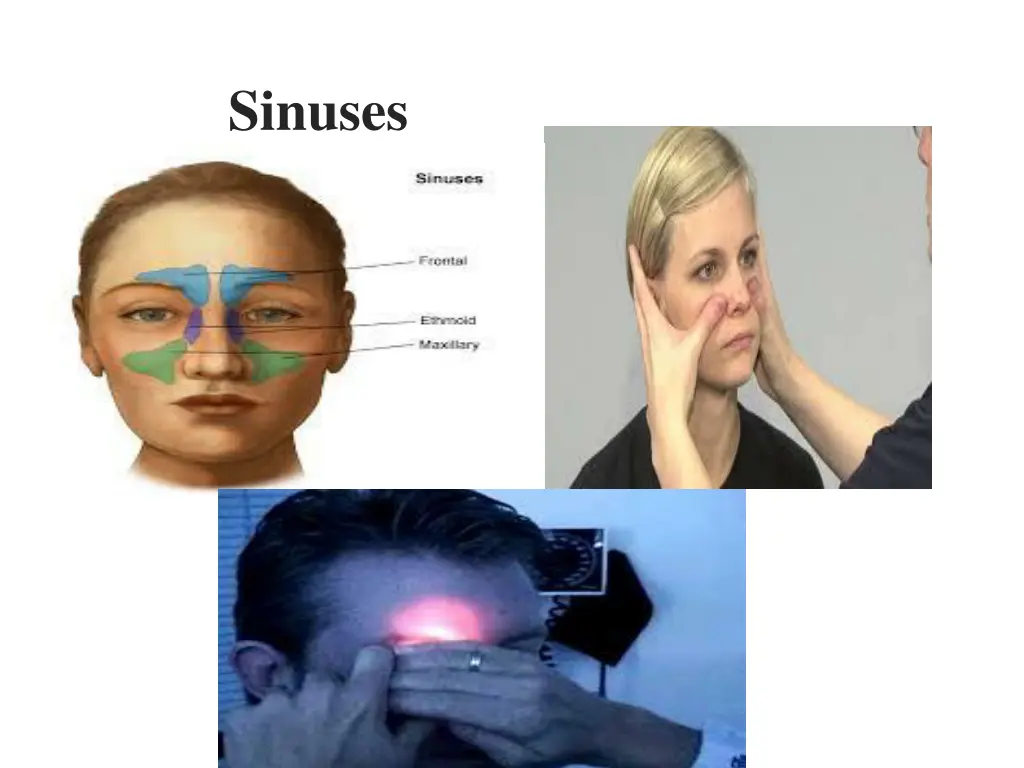 sinuses