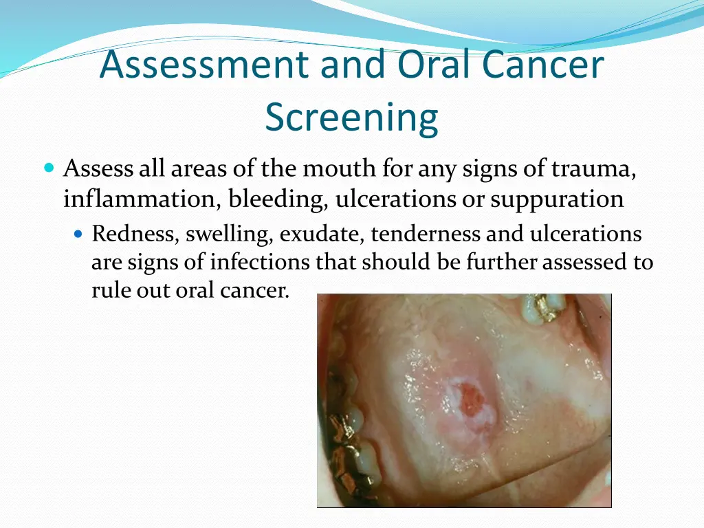 assessment and oral cancer screening