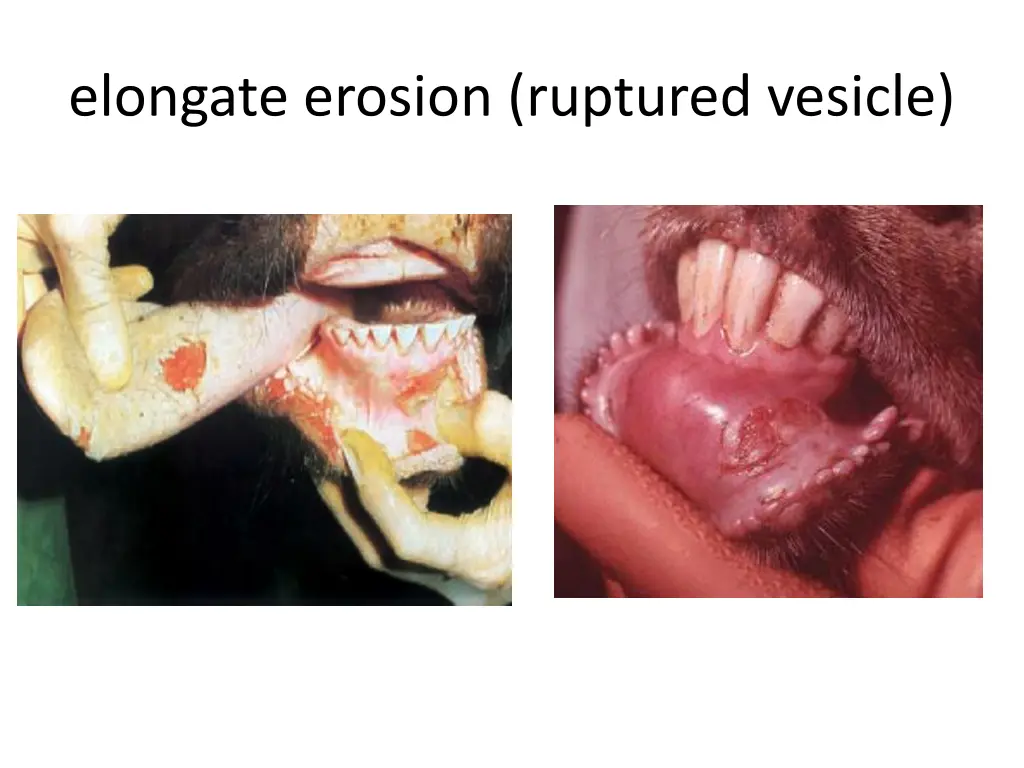 elongate erosion ruptured vesicle