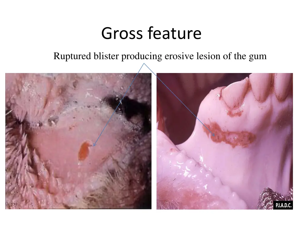 gross feature