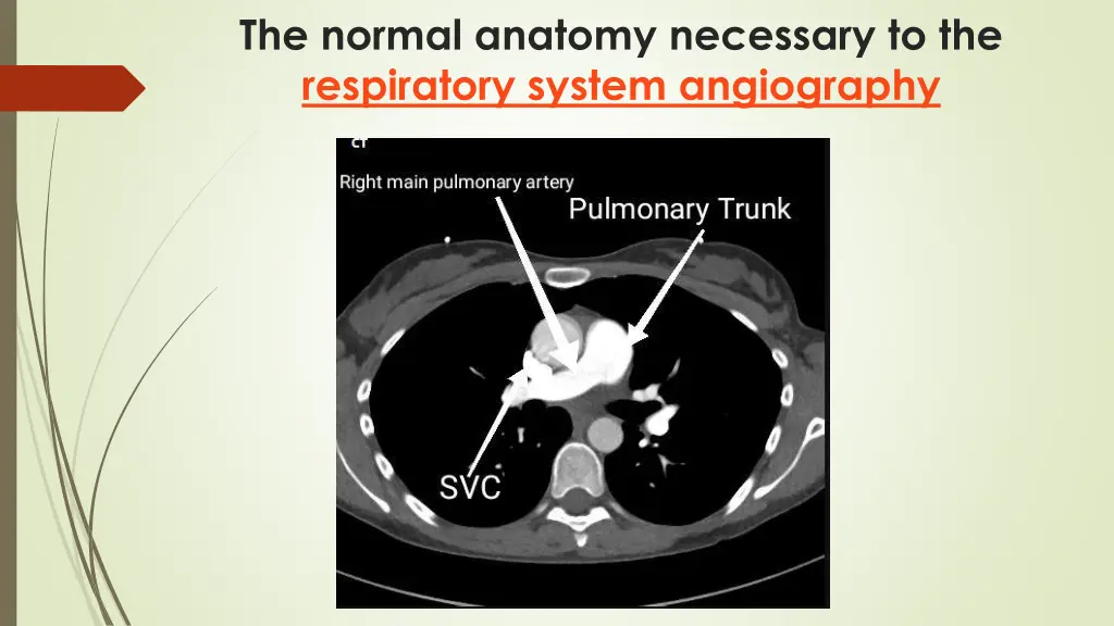 the normal anatomy necessary to the respiratory 10