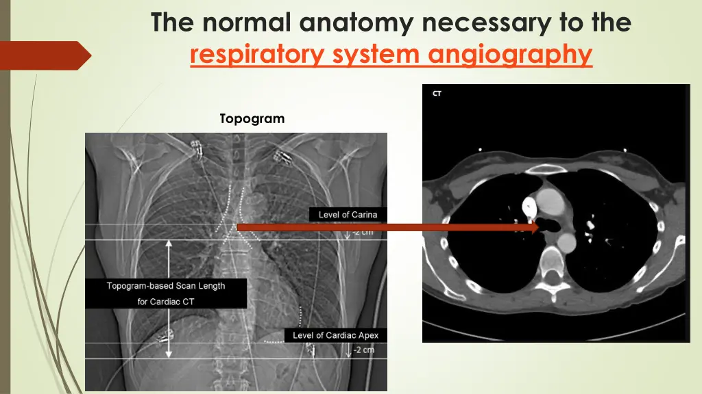 the normal anatomy necessary to the respiratory 14