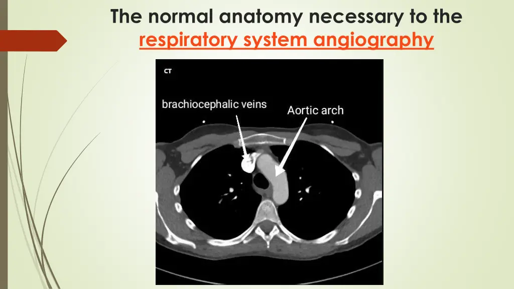 the normal anatomy necessary to the respiratory 3