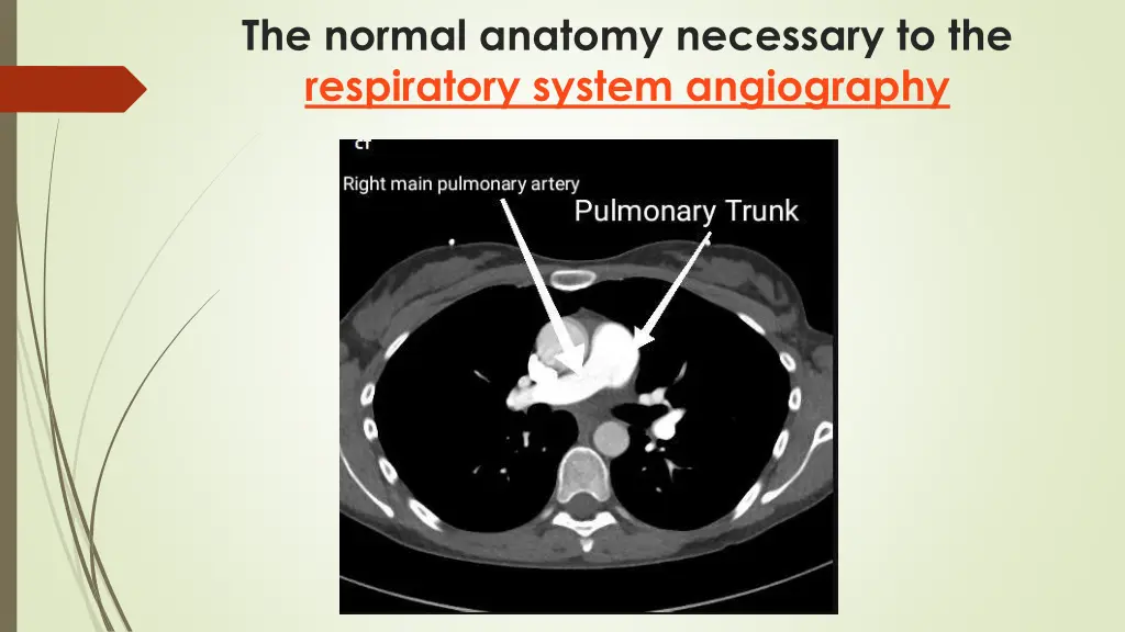 the normal anatomy necessary to the respiratory 8