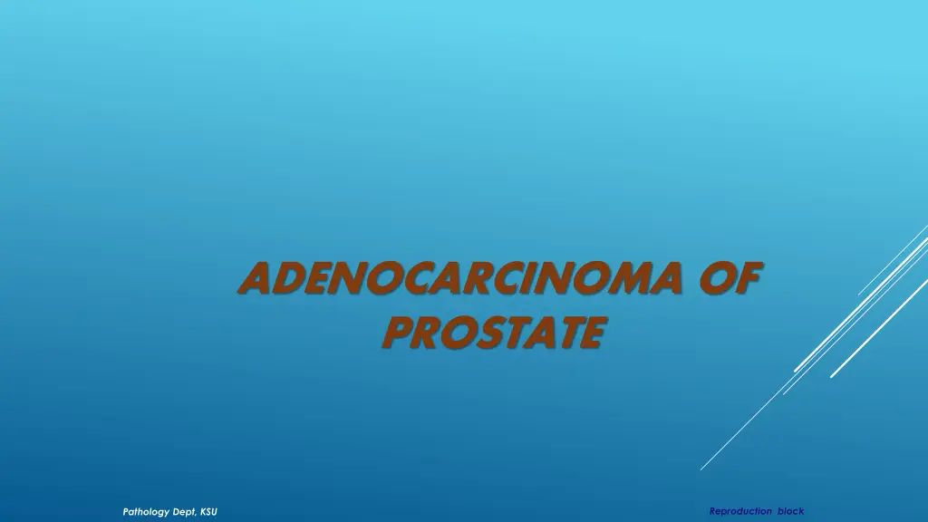 adenocarcinoma of prostate