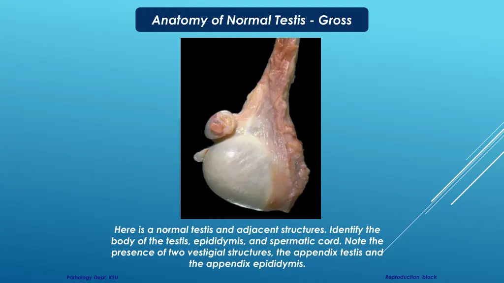 anatomy of normal testis gross