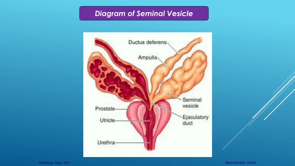 diagram of seminal vesicle