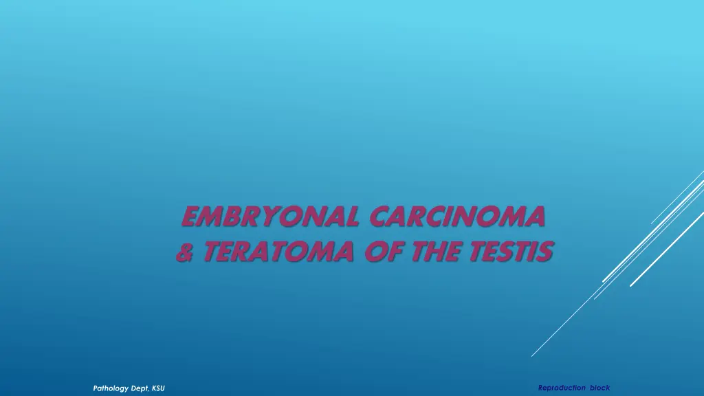 embryonal carcinoma teratoma of the testis