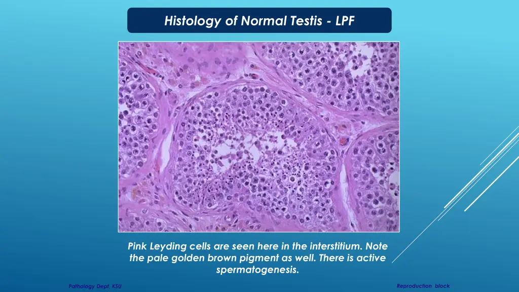 histology of normal testis lpf 1