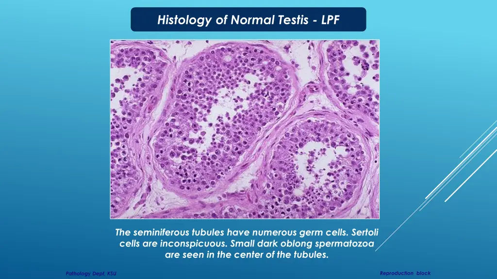 histology of normal testis lpf