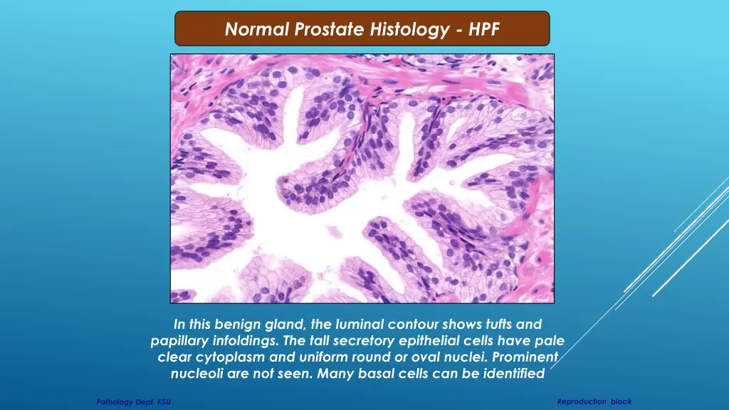 normal prostate histology hpf