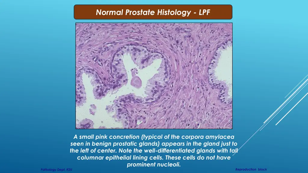 normal prostate histology lpf