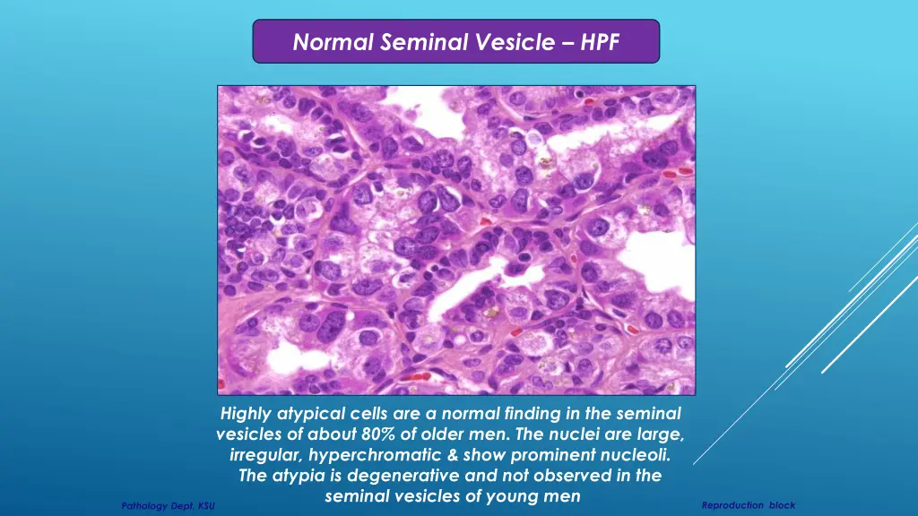 normal seminal vesicle hpf