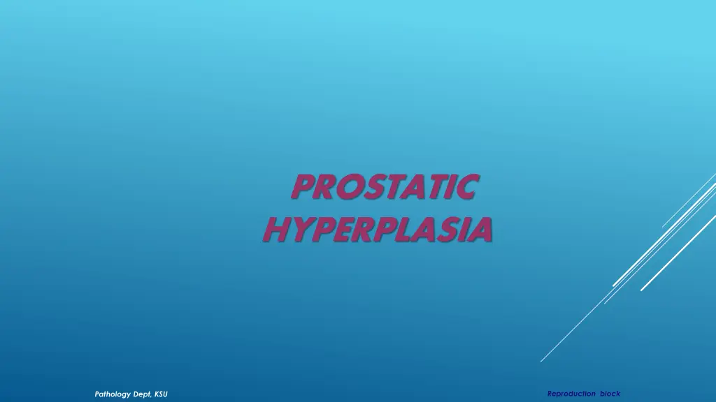 prostatic hyperplasia