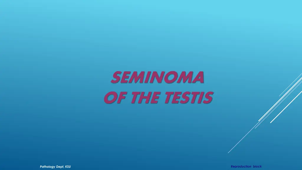 seminoma of the testis