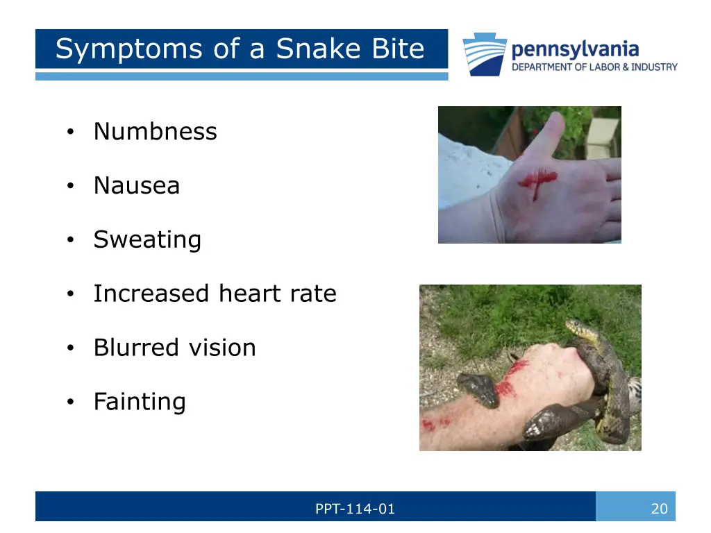 symptoms of a snake bite 1