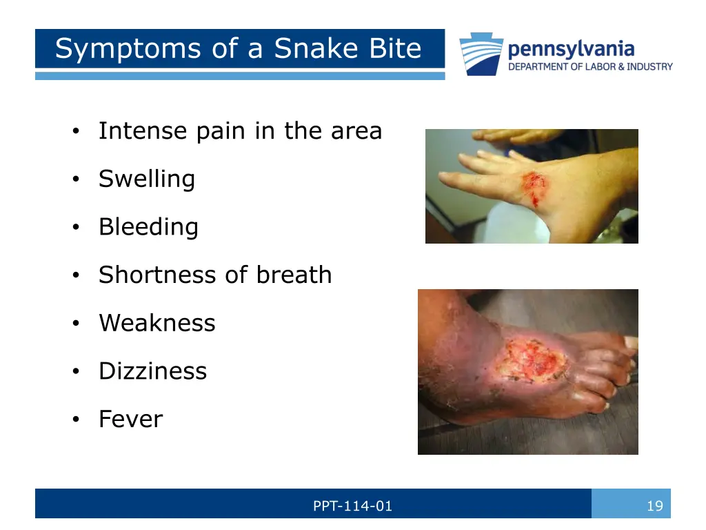 symptoms of a snake bite